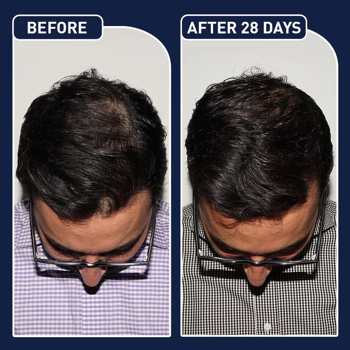 FEG PLUS HAIR GROWTH SPRAY USA