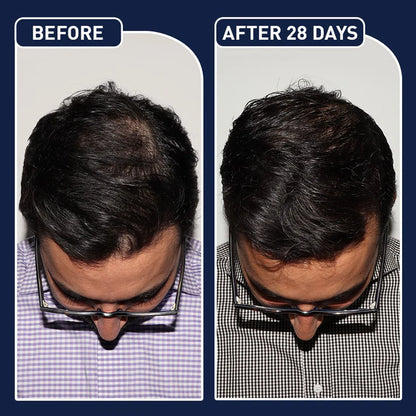 FEG PLUS HAIR GROWTH SPRAY USA