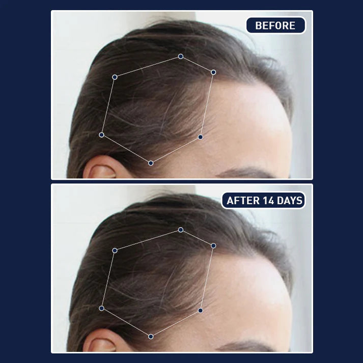 FEG PLUS HAIR GROWTH SPRAY USA