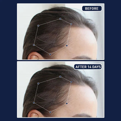 FEG PLUS HAIR GROWTH SPRAY USA